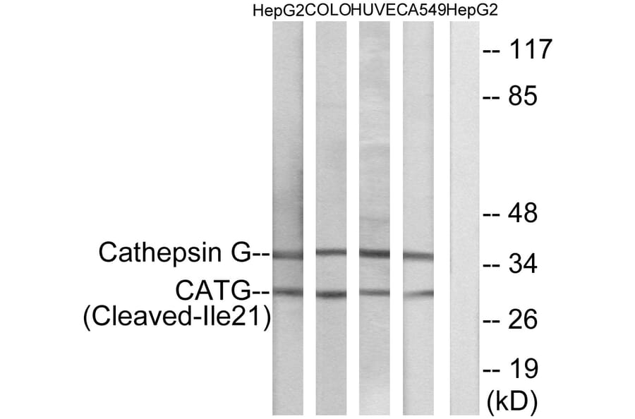 Western Blot - Anti-CATG (cleaved Ile21) Antibody (L0179) - Antibodies.com