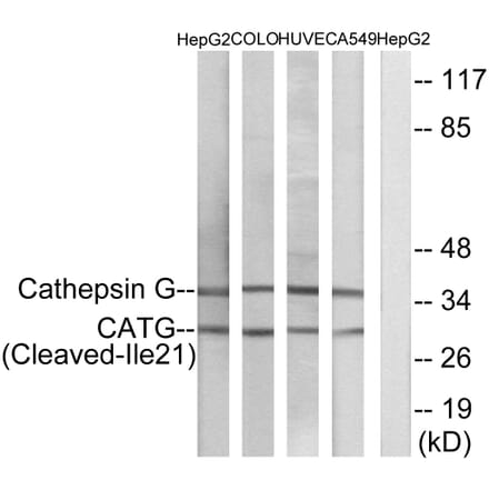 Western Blot - Anti-CATG (cleaved Ile21) Antibody (L0179) - Antibodies.com