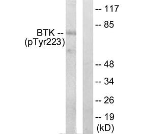 Western Blot - Anti-BTK (phospho Tyr223) Antibody (A0054) - Antibodies.com