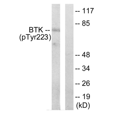 Western Blot - Anti-BTK (phospho Tyr223) Antibody (A0054) - Antibodies.com