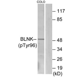 Western Blot - Anti-BLNK (phospho Tyr96) Antibody (A0620) - Antibodies.com