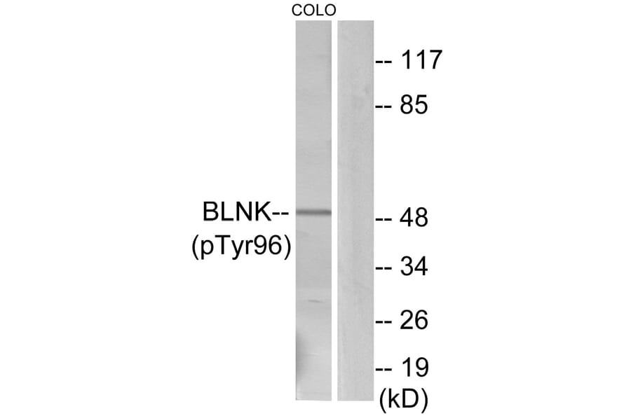 Western Blot - Anti-BLNK (phospho Tyr96) Antibody (A0620) - Antibodies.com