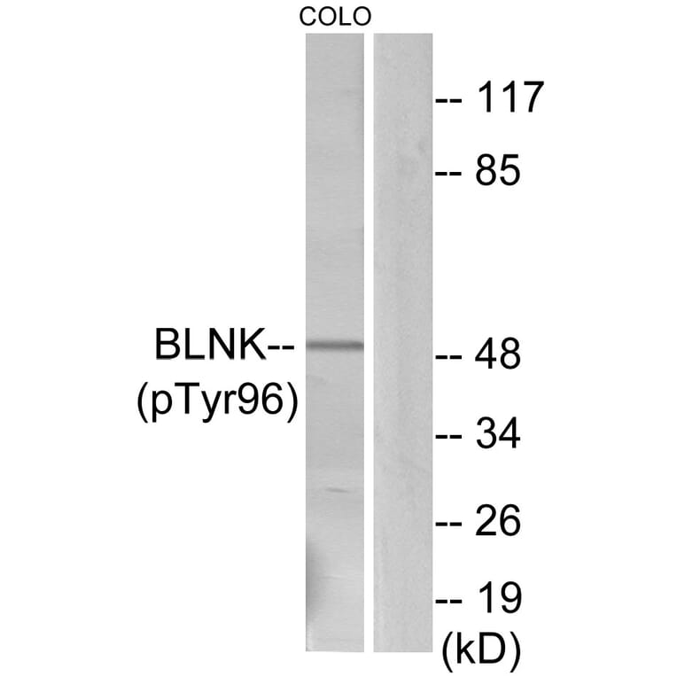 Western Blot - Anti-BLNK (phospho Tyr96) Antibody (A0620) - Antibodies.com