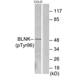 Western Blot - Anti-BLNK (phospho Tyr96) Antibody (A0620) - Antibodies.com