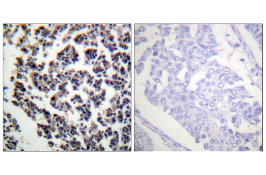 Immunohistochemistry - Anti-BLNK (phospho Tyr96) Antibody (A0620) - Antibodies.com