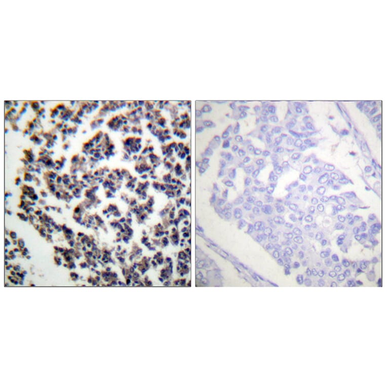 Immunohistochemistry - Anti-BLNK (phospho Tyr96) Antibody (A0620) - Antibodies.com