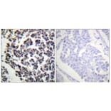 Immunohistochemistry - Anti-BLNK (phospho Tyr96) Antibody (A0620) - Antibodies.com