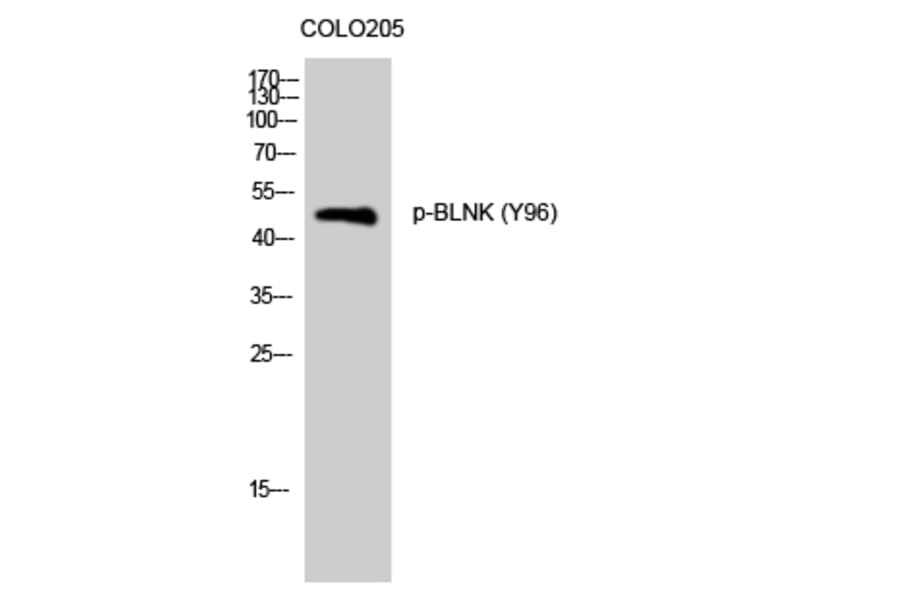 Western Blot - Anti-BLNK (phospho Tyr96) Antibody (A0620) - Antibodies.com