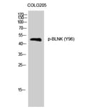 Western Blot - Anti-BLNK (phospho Tyr96) Antibody (A0620) - Antibodies.com