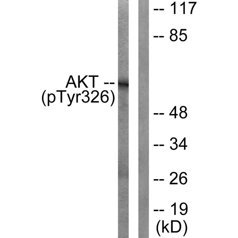 Western Blot - Anti-Akt (phospho Tyr326) Antibody (A0817) - Antibodies.com