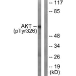 Western Blot - Anti-Akt (phospho Tyr326) Antibody (A0817) - Antibodies.com