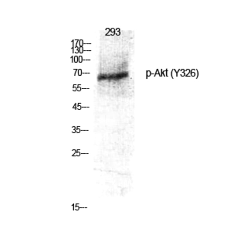 Western Blot - Anti-Akt (phospho Tyr326) Antibody (A0817) - Antibodies.com