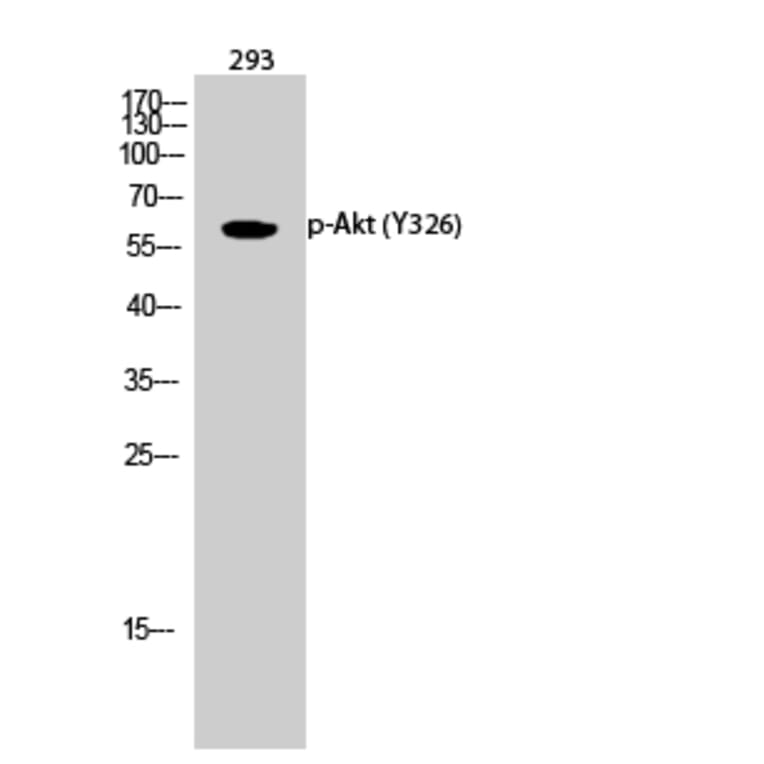 Western Blot - Anti-Akt (phospho Tyr326) Antibody (A0817) - Antibodies.com