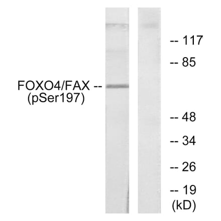 Western Blot - Anti-AFX (phospho Ser197) Antibody (A7088) - Antibodies.com