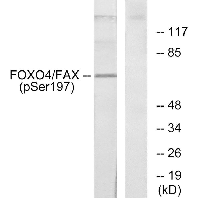Western Blot - Anti-AFX (phospho Ser197) Antibody (A7088) - Antibodies.com