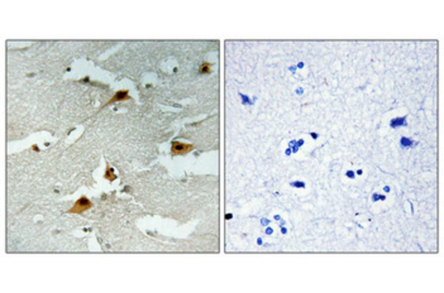 Immunohistochemistry - Anti-AFX (phospho Ser197) Antibody (A7088) - Antibodies.com