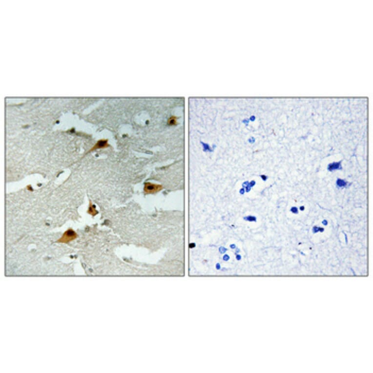 Immunohistochemistry - Anti-AFX (phospho Ser197) Antibody (A7088) - Antibodies.com