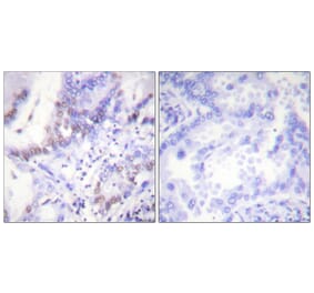 Immunohistochemistry - Anti-Abl (phospho Tyr412) Antibody (A0403) - Antibodies.com