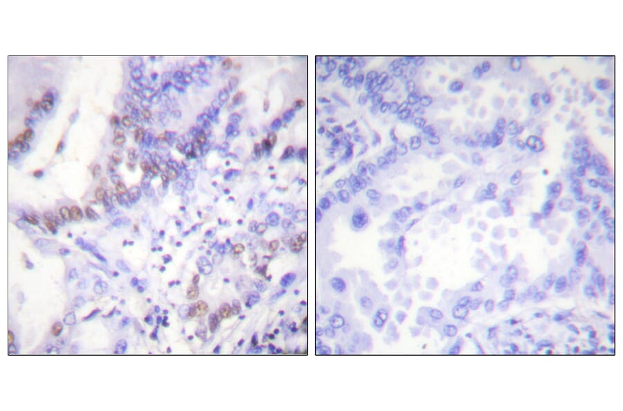 Immunohistochemistry - Anti-Abl (phospho Tyr412) Antibody (A0403) - Antibodies.com
