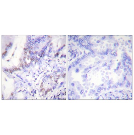 Immunohistochemistry - Anti-Abl (phospho Tyr412) Antibody (A0403) - Antibodies.com