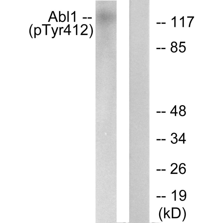 Western Blot - Anti-Abl (phospho Tyr412) Antibody (A0403) - Antibodies.com