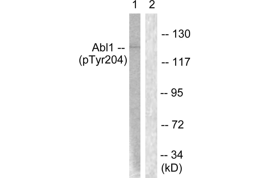 Western Blot - Anti-Abl (phospho Tyr204) Antibody (A0404) - Antibodies.com