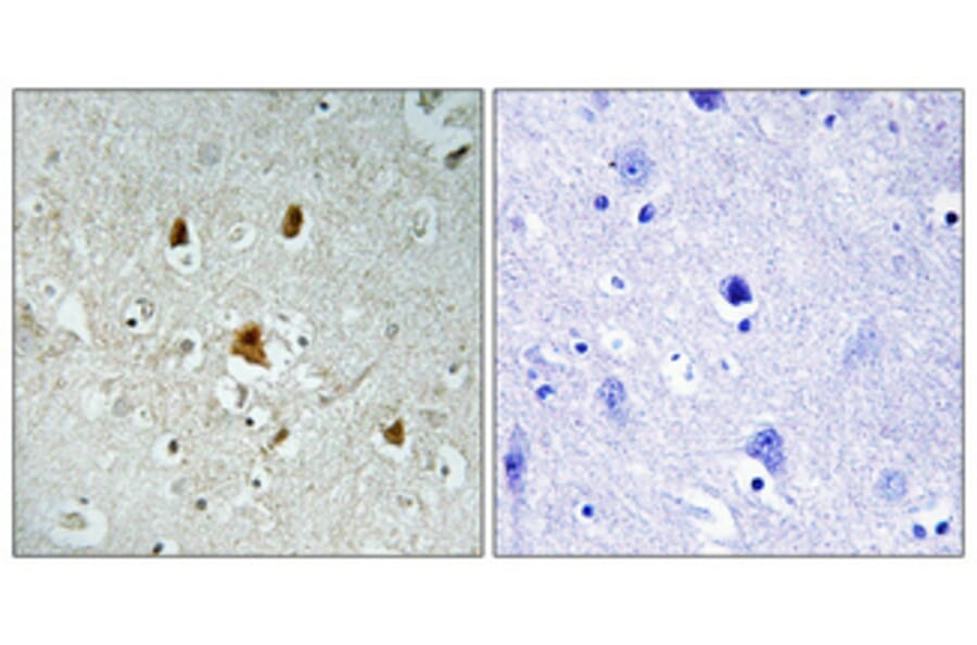 Immunohistochemistry - Anti-Abl (phospho Tyr204) Antibody (A0404) - Antibodies.com