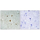 Immunohistochemistry - Anti-Abl (phospho Tyr204) Antibody (A0404) - Antibodies.com