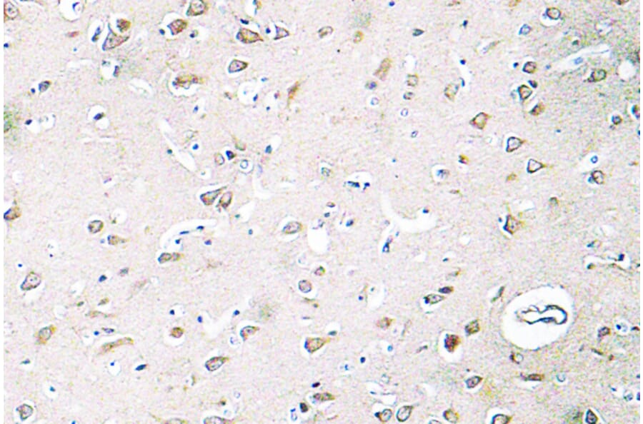 Immunohistochemistry - Anti-PI 3-kinase p85beta Antibody (R12-2308) - Antibodies.com