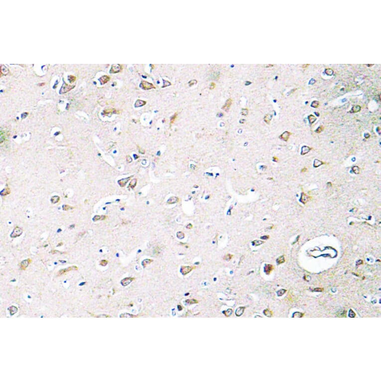 Immunohistochemistry - Anti-PI 3-kinase p85beta Antibody (R12-2308) - Antibodies.com