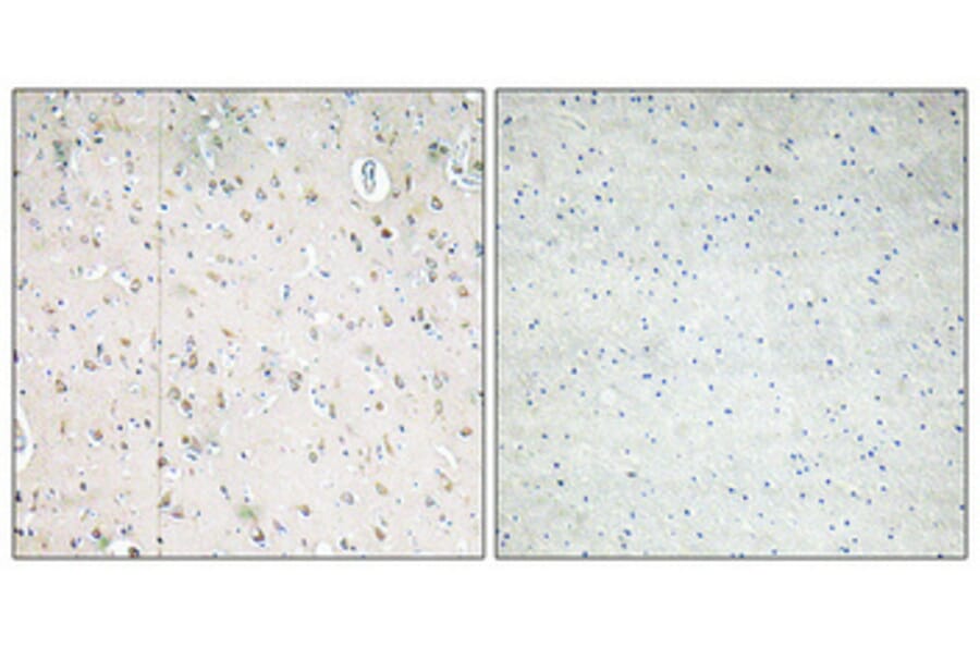 Immunohistochemistry - Anti-PI 3-kinase p85beta Antibody (R12-2308) - Antibodies.com
