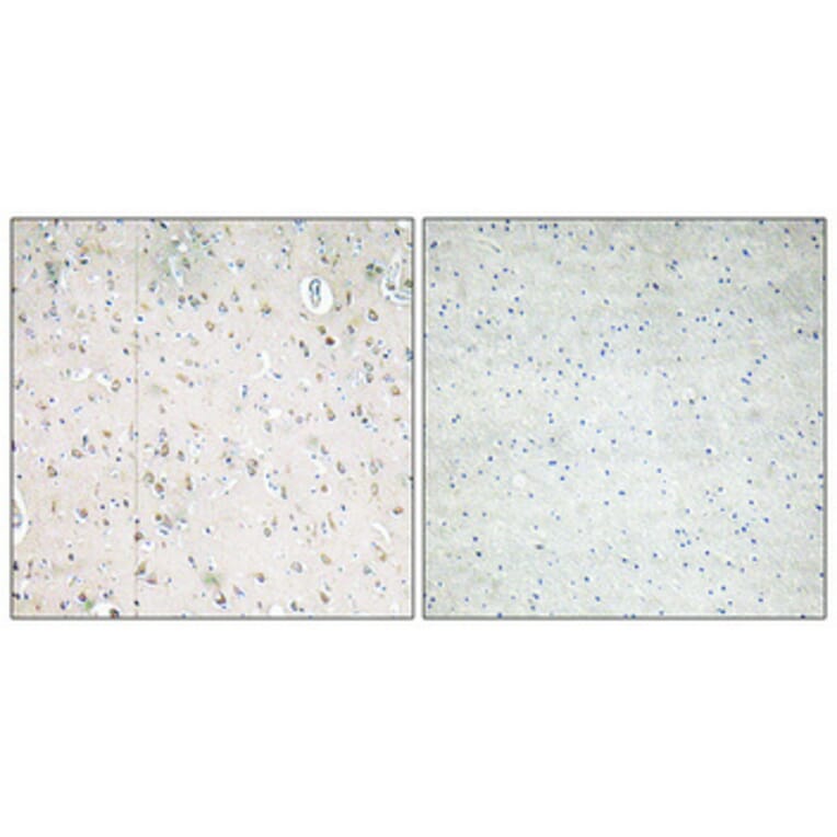 Immunohistochemistry - Anti-PI 3-kinase p85beta Antibody (R12-2308) - Antibodies.com