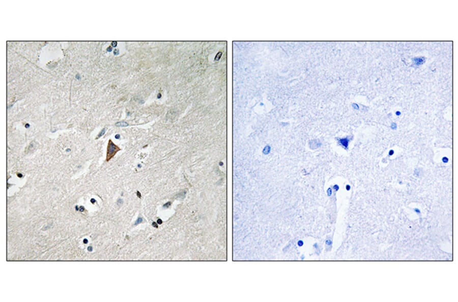 Immunohistochemistry - Anti-PDK1 (phospho Tyr9) Antibody (A8055) - Antibodies.com