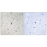 Immunohistochemistry - Anti-PDK1 (phospho Tyr9) Antibody (A8055) - Antibodies.com