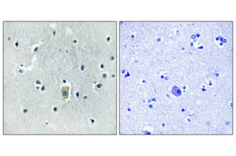 Immunohistochemistry - Anti-BIM (phospho Ser59) Antibody (A8206) - Antibodies.com