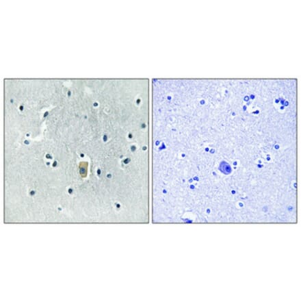 Immunohistochemistry - Anti-BIM (phospho Ser59) Antibody (A8206) - Antibodies.com