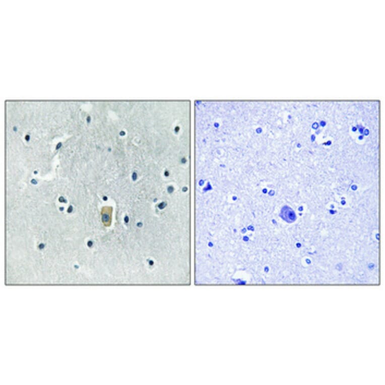 Immunohistochemistry - Anti-BIM (phospho Ser59) Antibody (A8206) - Antibodies.com