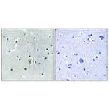 Immunohistochemistry - Anti-BIM (phospho Ser59) Antibody (A8206) - Antibodies.com