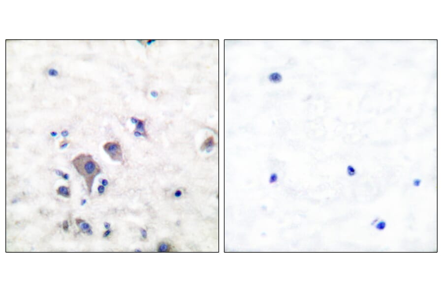 Immunohistochemistry - Anti-mGluR2 + mGluR3 Antibody (C0207) - Antibodies.com