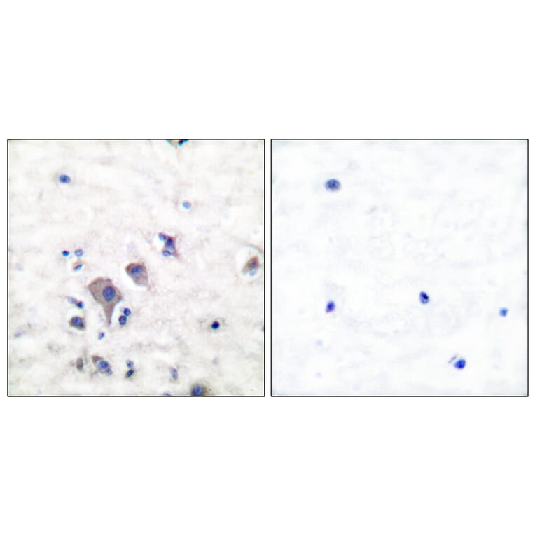 Immunohistochemistry - Anti-mGluR2 + mGluR3 Antibody (C0207) - Antibodies.com
