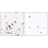 Immunohistochemistry - Anti-mGluR2 + mGluR3 Antibody (C0207) - Antibodies.com