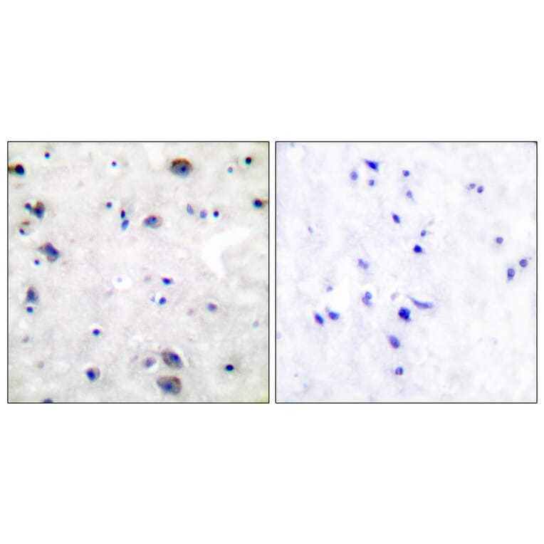 Immunohistochemistry - Anti-Opioid Receptor Antibody (B0022) - Antibodies.com