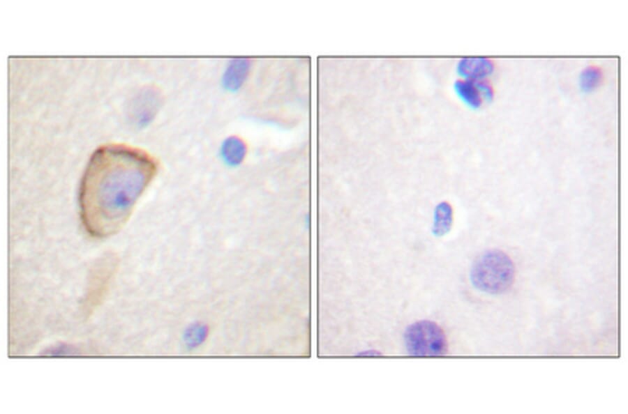 Immunohistochemistry - Anti-Opioid Receptor Antibody (B0022) - Antibodies.com