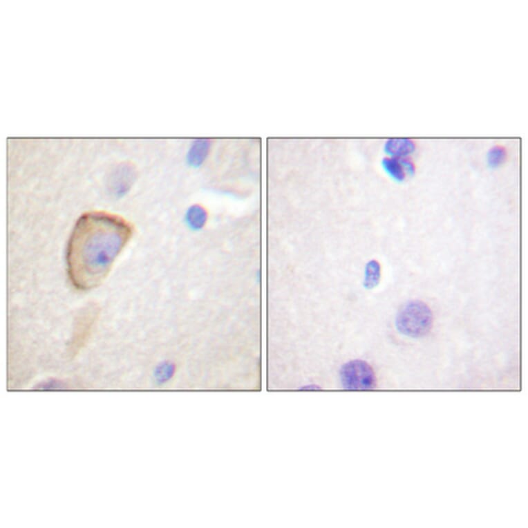 Immunohistochemistry - Anti-Opioid Receptor Antibody (B0022) - Antibodies.com