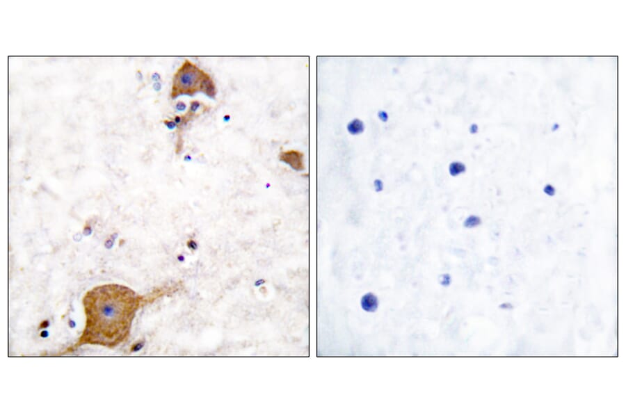 Immunohistochemistry - Anti-NRG1 isoform-10 Antibody (C0229) - Antibodies.com