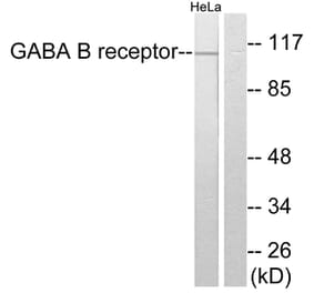 Western Blot - Anti-GABA-B Receptor Antibody (C0198) - Antibodies.com