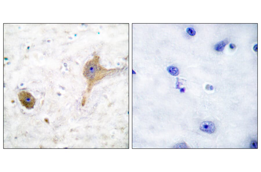 Immunohistochemistry - Anti-GABA-B Receptor Antibody (C0198) - Antibodies.com