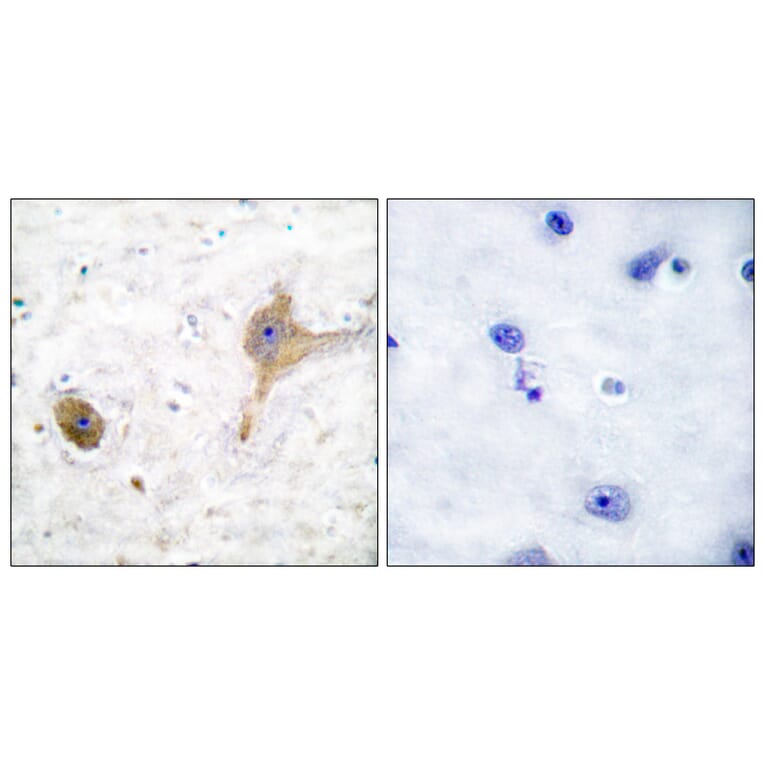 Immunohistochemistry - Anti-GABA-B Receptor Antibody (C0198) - Antibodies.com