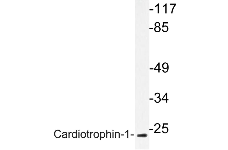 Western Blot - Anti-Cardiotrophin-1 Antibody (R12-2052) - Antibodies.com