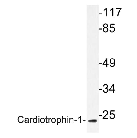 Western Blot - Anti-Cardiotrophin-1 Antibody (R12-2052) - Antibodies.com
